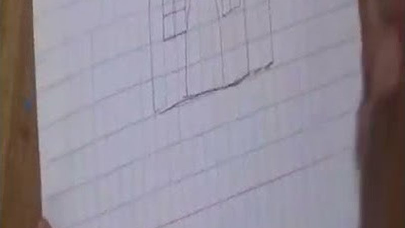 半口种植牙术后恢复：全程揭秘与注意事项**